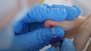 ग्वाडा-निगेटिव दुनिया का सबसे नया और दुर्लभ ब्लड ग्रुप मिला, ग्वाडेलूप की महिला में 48वां रक्त समूह…