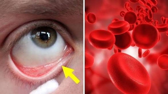 सावधान शरीर में आयरन की कमी दिखने से पहले देता है ये 5 संकेत…